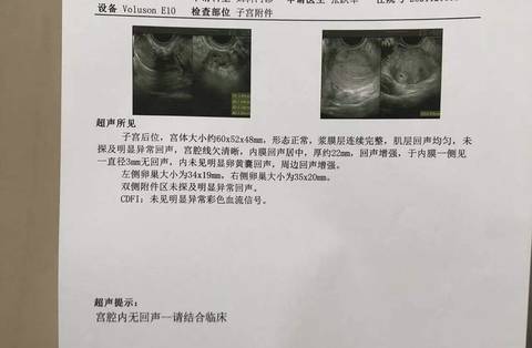 journal_insert_pic_1681581704