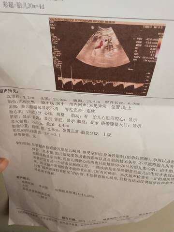 journal_insert_pic_1674633660