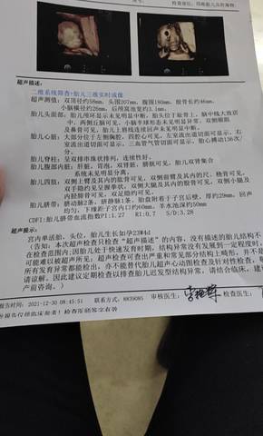 journal_insert_pic_1690085959