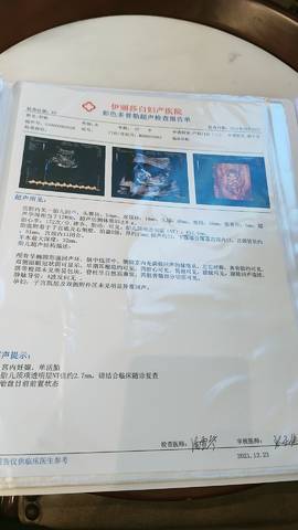 journal_insert_pic_1685006274