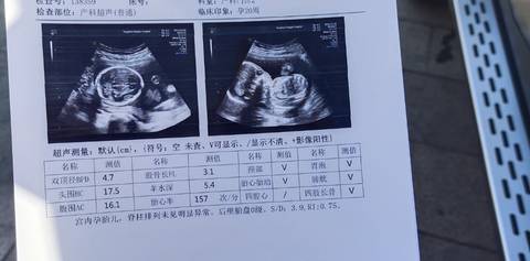 journal_insert_pic_1688338416