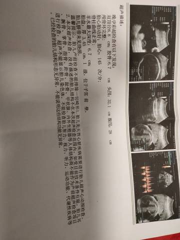 journal_insert_pic_1679280785