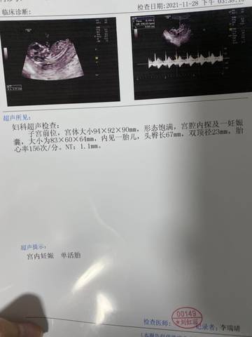 journal_insert_pic_1678059713