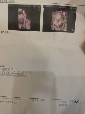 journal_insert_pic_1689703500