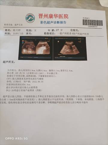 journal_insert_pic_1689995222