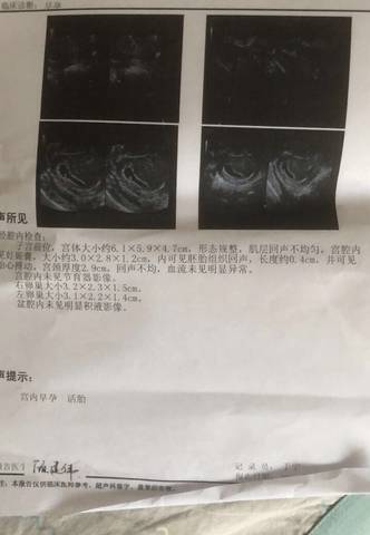 journal_insert_pic_1678033648