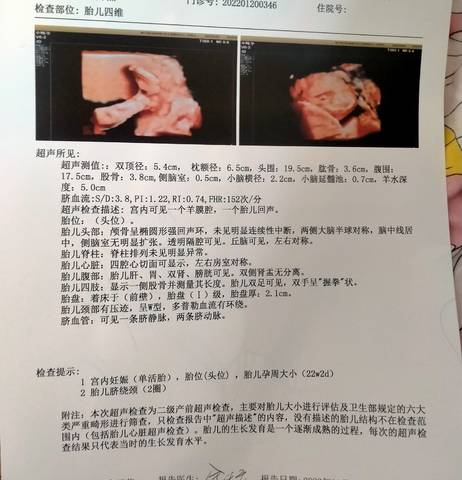 journal_insert_pic_1719468825