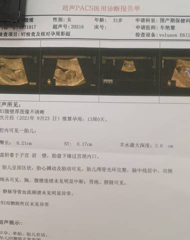 journal_insert_pic_1684935847