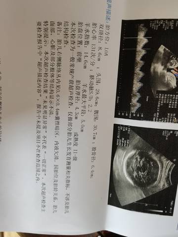 journal_insert_pic_1741038939