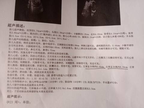 journal_insert_pic_1688355470