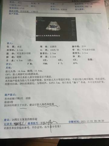 journal_insert_pic_1684970353