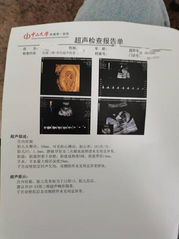 journal_insert_pic_1678278764