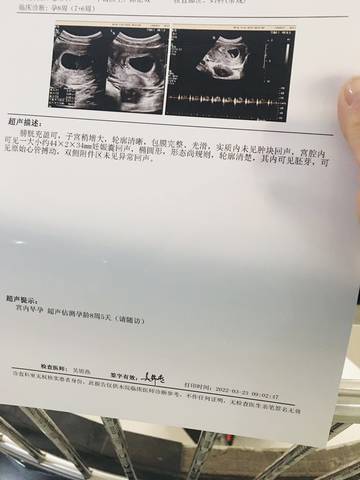journal_insert_pic_1740918650