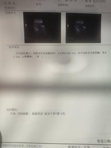 journal_insert_pic_1675967003