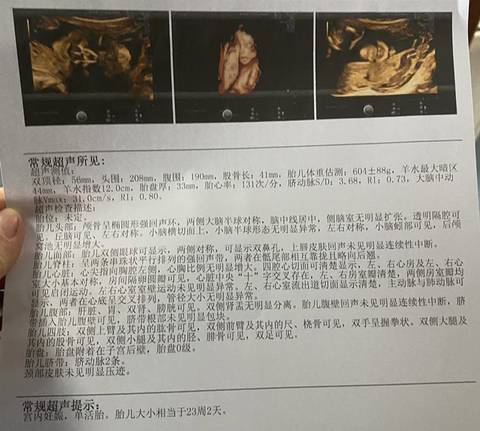 journal_insert_pic_1689438900