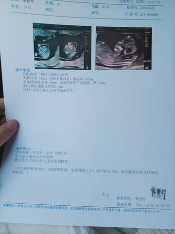journal_insert_pic_1674918810