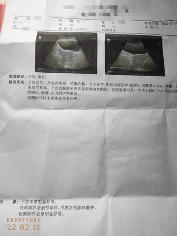 journal_insert_pic_1719515331