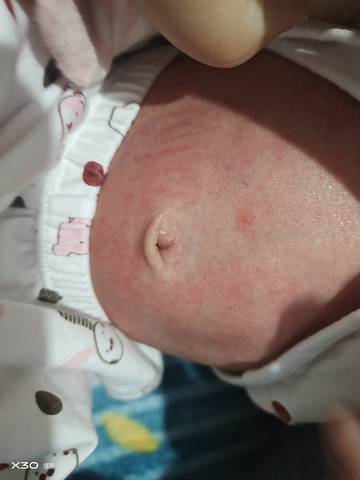 journal_insert_pic_1677526113