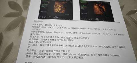 journal_insert_pic_1681875075