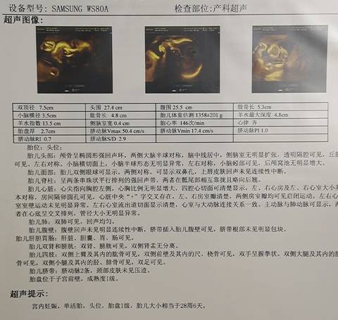 journal_insert_pic_1684286695