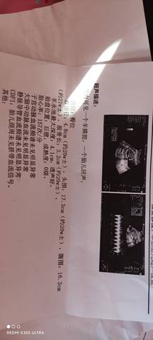 journal_insert_pic_1681335547