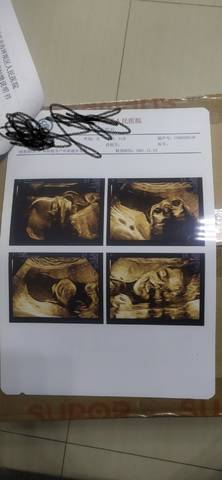 journal_insert_pic_1686522886