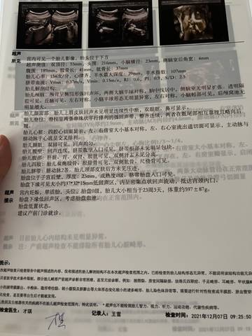 journal_insert_pic_1675376441
