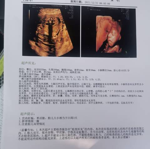 journal_insert_pic_1686113465