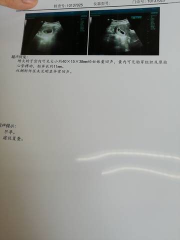 journal_insert_pic_1690566352