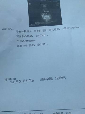 journal_insert_pic_1719496974