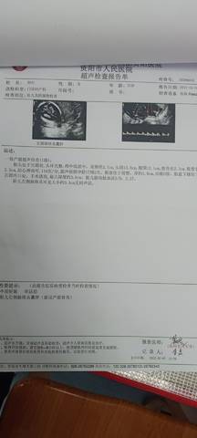 journal_insert_pic_1719501448