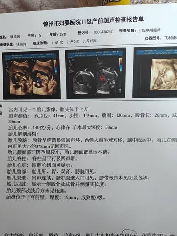 journal_insert_pic_1675488864