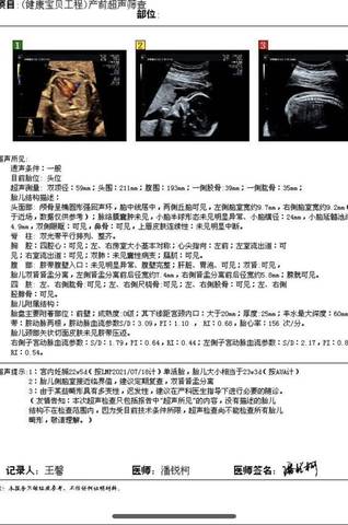 journal_insert_pic_1685242597