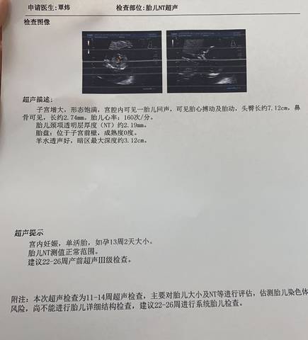 journal_insert_pic_1685240765