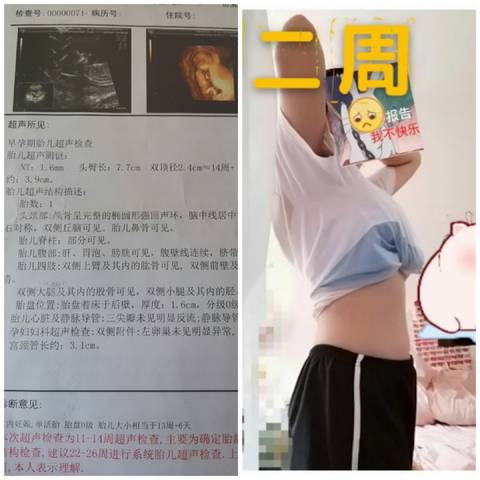 journal_insert_pic_1688385036