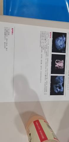 journal_insert_pic_1673593109