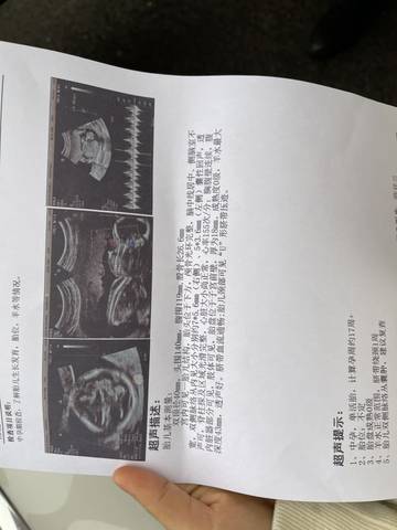 journal_insert_pic_1686041510