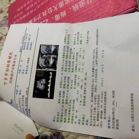 journal_insert_pic_1689514349