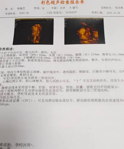 journal_insert_pic_1686482114
