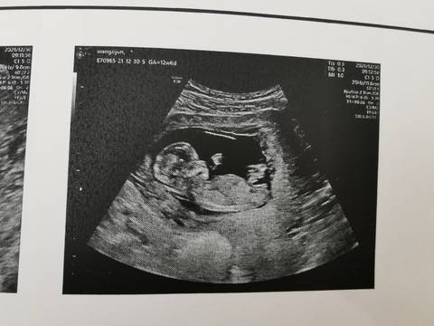 journal_insert_pic_1688880837