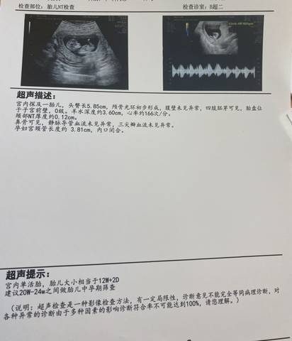 journal_insert_pic_1682582959