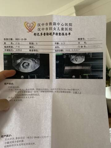 journal_insert_pic_1690075000