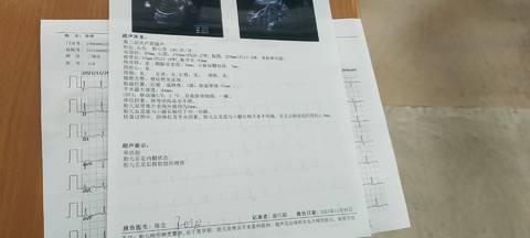 journal_insert_pic_1682838479