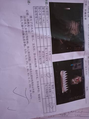 journal_insert_pic_1677358532