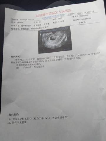 journal_insert_pic_1675483096