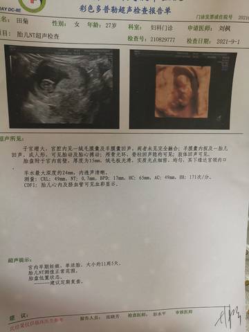 journal_insert_pic_1682389776