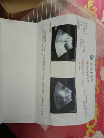 journal_insert_pic_1679230351