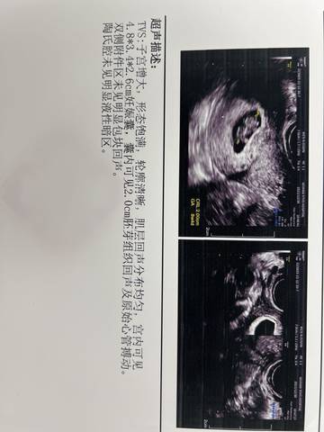 journal_insert_pic_1688823005