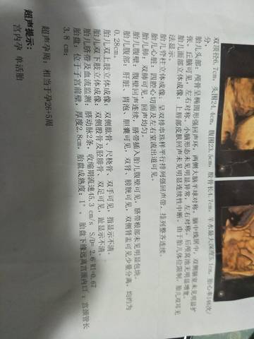 journal_insert_pic_1685521006