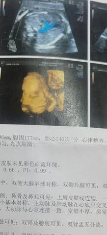 journal_insert_pic_1678867278
